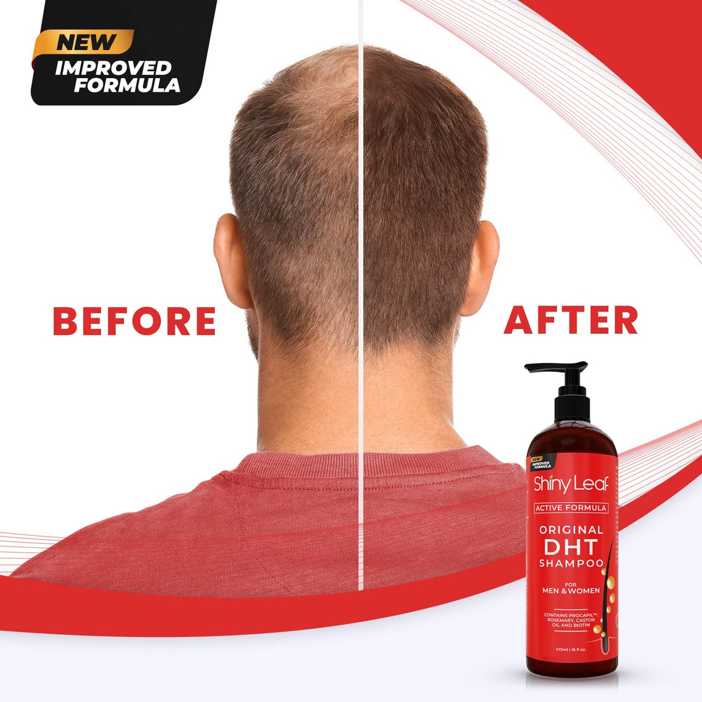 Shiny Leaf DHT Blocker Anti Hair Loss Shampoo and Conditioner set with Biotin (2