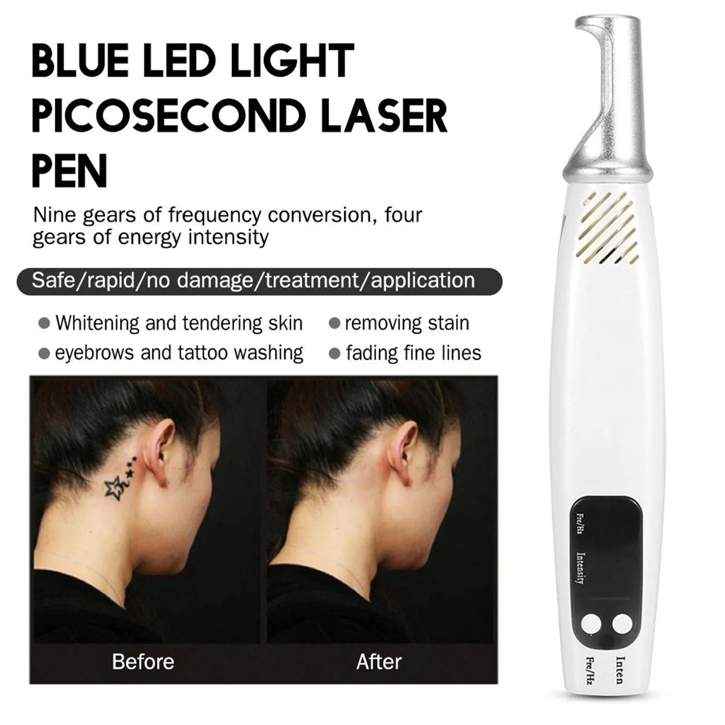 Handheld Picosecond Laser Pen Tattoo Scar Freckle Removal Machine Skin Beauty Device