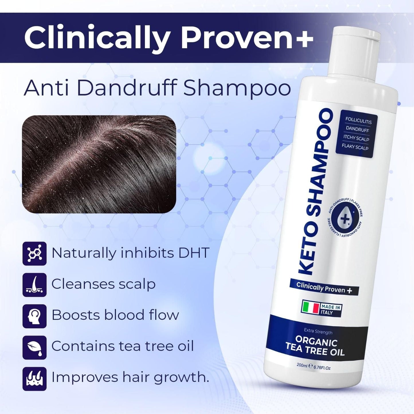 Anti Dandruff Shampoo Sulfate Free Shampoo Medicated Anti Fungal Shampoo For Itchy Flaky Dry Scalp Hair Growth Folliculitis Treatment Seborrheic Dermatitis Shampoo with Tea Tree Oil EasyOptionXY LLC