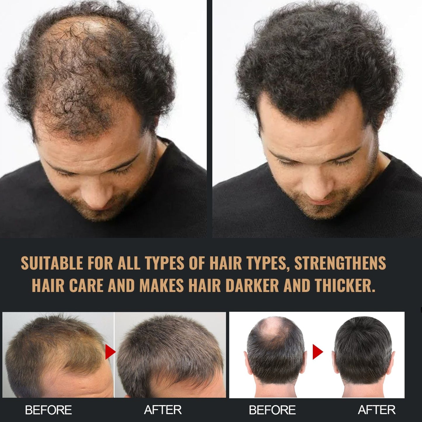 Root Activator Shampoo, Natural Hair Regrowth Shampoos, Unisex Hair Thickening Shampoo, Gently Shampoo For Men & Women, Nourishing Long Lasting Hair Care For Darker & Thicker Hair EasyOptionXY LLC