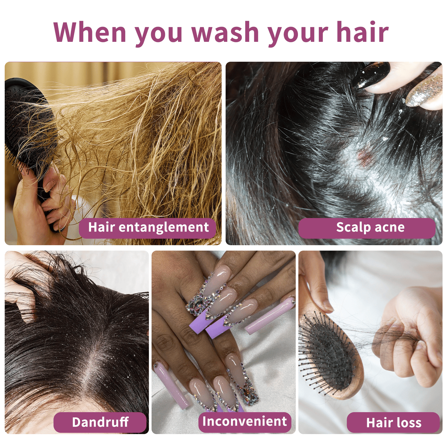 Silicone Scalp Massager for Hair Growth, Scalp Scrubber Brush for Shower, Andruff Exfoliating Stress Relax Wet Dry Scalp Brush, Deeply Cleanses Scalp Pores