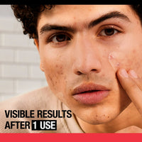 Neutrogena Stubborn Acne Treatment, Blemish Patches, Small and Large, 10 count EasyOptionXY LLC