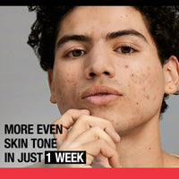 Neutrogena Stubborn Marks PM Treatment with Retinol SA, 1 fl. oz EasyOptionXY LLC