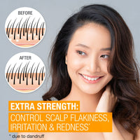 Neutrogena Scalp Therapy Anti-Dandruff Extra Strength EasyOptionXY LLC