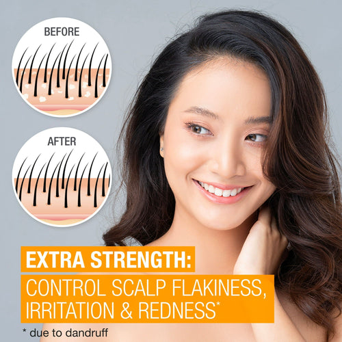 Neutrogena Scalp Therapy Anti-Dandruff Extra Strength EasyOptionXY LLC