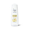 Dove DermaCare Scalp Dryness Daily Conditioner, Coconut and Shea Butter, 12 fl oz EasyOptionXY LLC