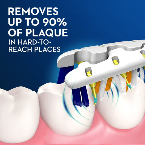 Oral-B Pulsar Expert Clean Compact Head Battery Toothbrush, Soft, 4 Count, for Adults and Children 3+ EasyOptionXY LLC