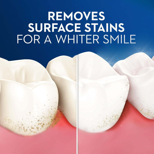 Oral-B Pulsar Charcoal Battery Toothbrush, Soft, 1 Count EasyOptionXY LLC