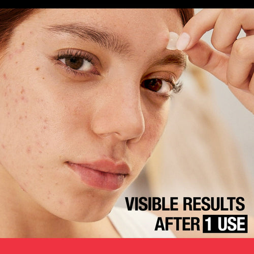 Neutrogena Stubborn Acne Hydrocolloid Acne Treatment Patch, 24 Ct EasyOptionXY LLC