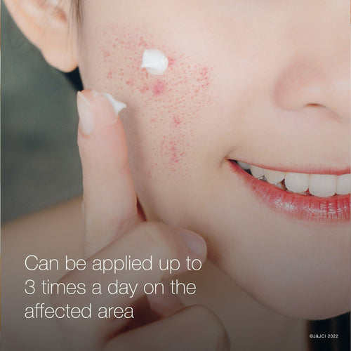 Neutrogena Rapid Clear Stubborn Acne Medication Spot Treatment Gel, 1 oz EasyOptionXY LLC