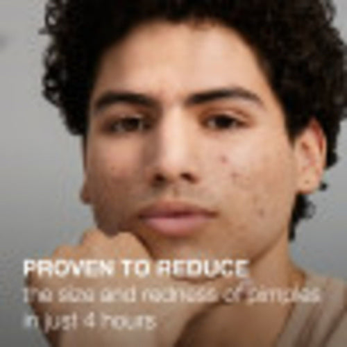 Neutrogena Stubborn Acne AM Treatment with Benzoyl Peroxide, 2.0 oz EasyOptionXY LLC