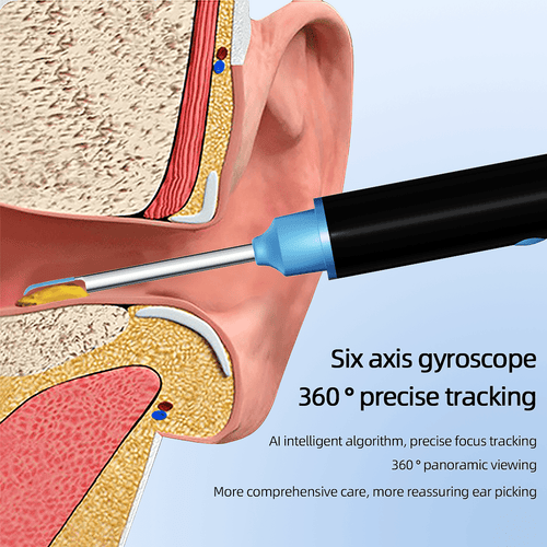 Kekoy Ear Camera and Wax Remover, 1080P Ear Wax Removal Kit, Wireless Otoscope Ear Cleaning Kit with Lights and 6 Ear Scoops EasyOptionXY LLC