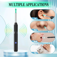 KEKOY Ear Cleaner with Camera, Earwax Remover Tool, 1296P HD Ear Otoscope with 6 LED Lights, 6 Ear Spoon & 8 Tools Ear Wax Removal Kit for iPhone, iPad & Android Smart Phone EasyOptionXY LLC