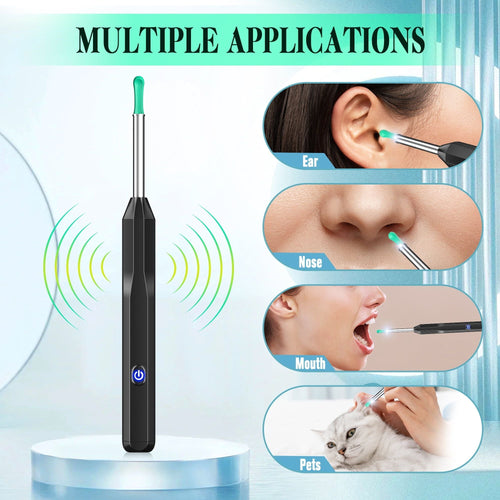 KEKOY Ear Cleaner with Camera, Earwax Remover Tool, 1296P HD Ear Otoscope with 6 LED Lights, 6 Ear Spoon & 8 Tools Ear Wax Removal Kit for iPhone, iPad & Android Smart Phone EasyOptionXY LLC