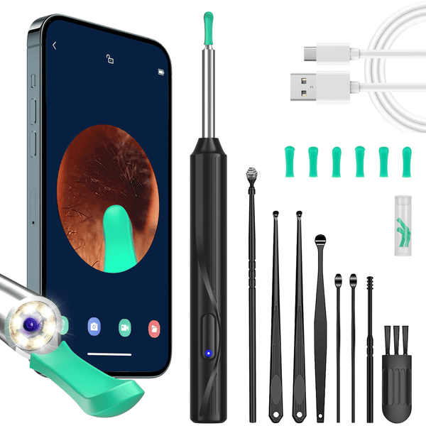 KEKOY Ear Camera and Wax Remover with 8 Pcs Ear Clean Set, Ear Wax Removal Tool, Ear Cleaner with 1296P Camera and 6 Light, Smart Visual Earwax Cleaning Kit for Daily Ear Pick EasyOptionXY LLC