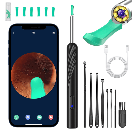 KEKOY Ear Wax Removal, Ear Cleaner Kit with 1296P HD, Ear Camera and Wax Remover, Ear Cleaning Kit with 6 Ear Spoon, Otoscope with Light, Ear Camera Include 8 Ear Set EasyOptionXY LLC