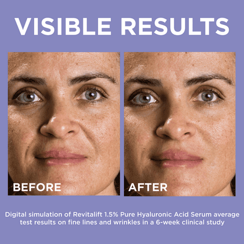L'Oreal Paris Revitalift Pure Hylauronic Acid Face Serum, 0.5 fl oz EasyOptionXY LLC