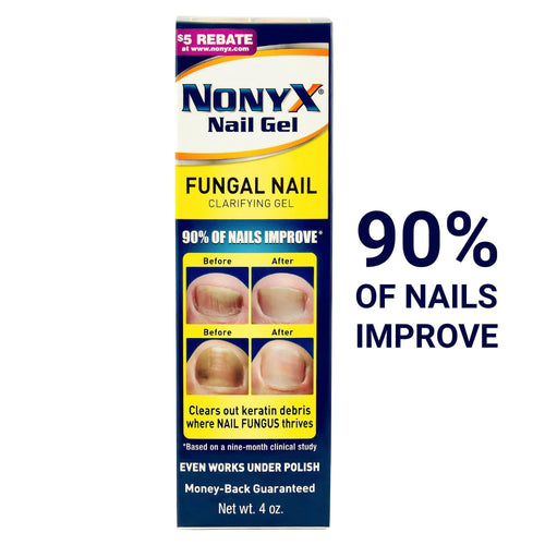 Nonyx Fungal Nail Clarifying Gel Clears Out Keratin Debris Where Nail Fungus Thrives 4 oz EasyOptionXY LLC