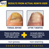 Nonyx Fungal Nail Clarifying Gel Clears Out Keratin Debris Where Nail Fungus Thrives 4 oz EasyOptionXY LLC