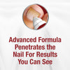 Kerasal Nail Fungal Nail Renewal Treatment for Discolored or Damaged Nails 10ml (0.33oz) EasyOptionXY LLC