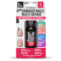 Nail-Aid - 5-in-1 Damaged Nails Multi-Repair for Fingernails or Toenails EasyOptionXY LLC