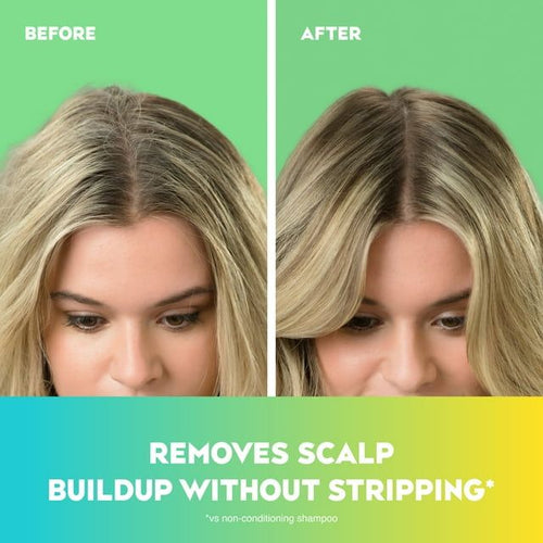 OGX Extra Strength Refreshing Scalp + Teatree Mint Nourishing Daily Shampoo, 13 fl oz EasyOptionXY LLC