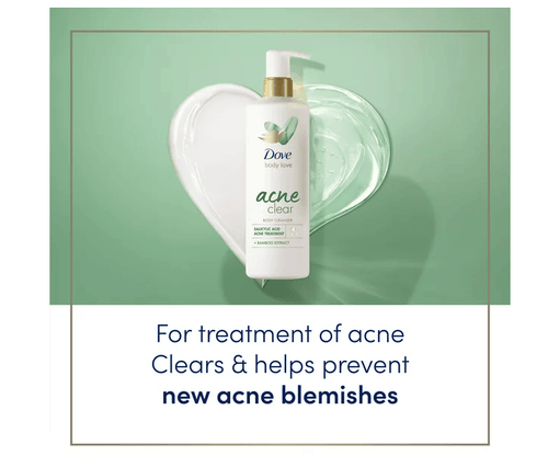 Dove Body Love Body Cleanser Acne Clear 17.5 fl oz EasyOptionXY LLC