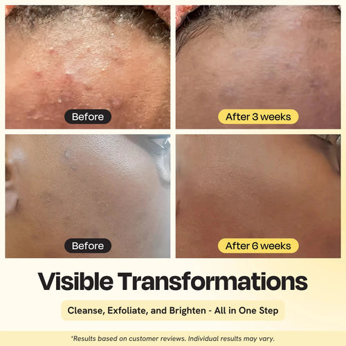 Clarifying Brightening Cleanser Gleamin