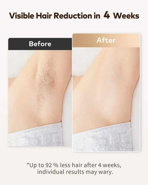 Permanent Laser Hair Removal Device Results in 4 Weeks Painless IPL Epilator 9 Levels 999900 Flashes Home Whole Body Treatment