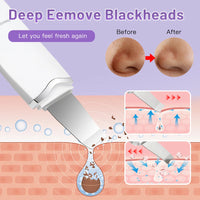 Electric Ultrasonic Skin Scrubber Vibration Face Spatula Peeling Blackhead Remover Facial Lifting Cleansing Ultrasonic Skin Care
