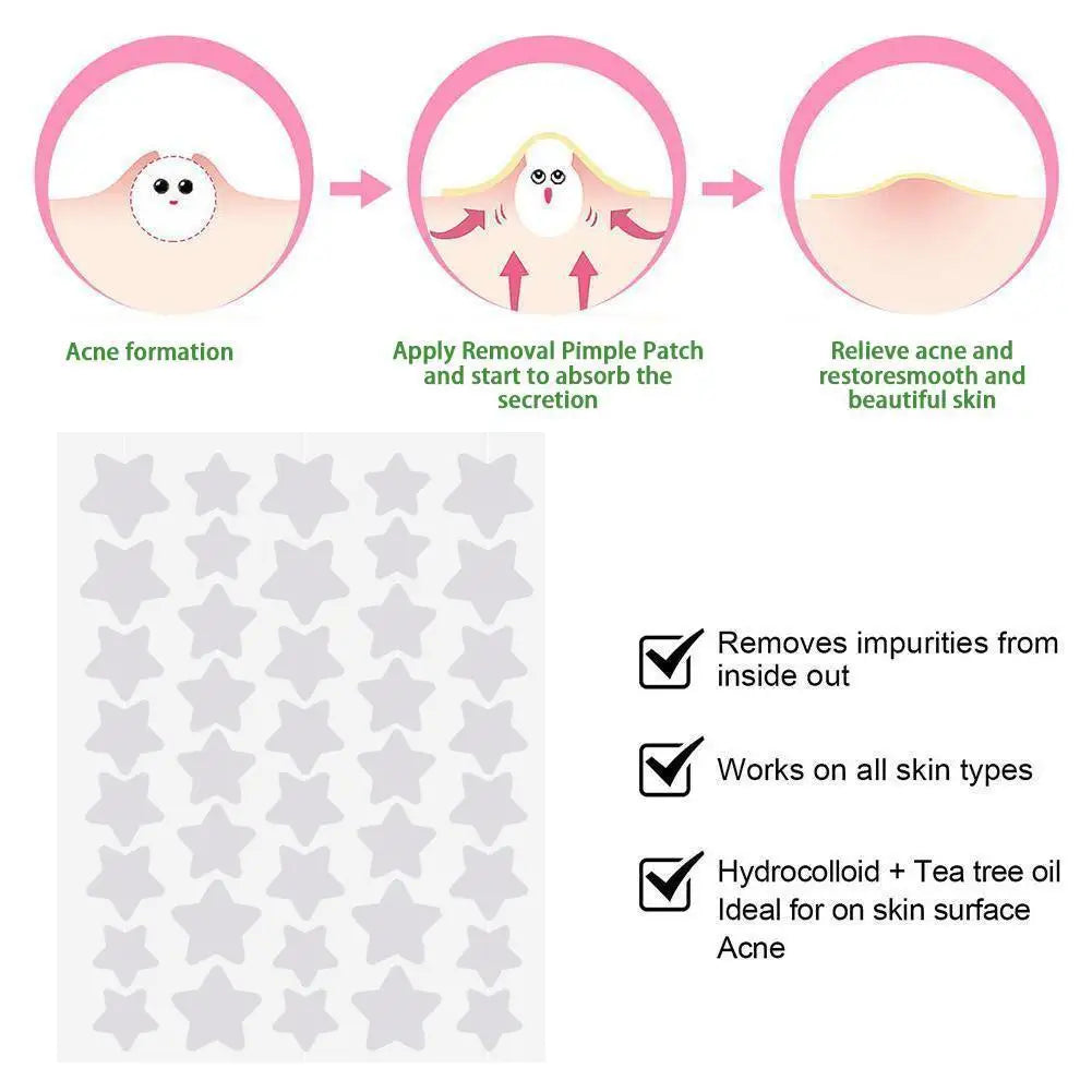 40pcs/Sheet Invisible Acne Pimple Patch Professional Face Skin Care Repair Acne Healing Absorbing Spot Sticker For Men Women
