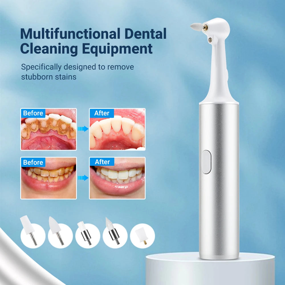 Electric Dental Scaler 5-in-1 - USB Rechargeable Teeth Cleaner
