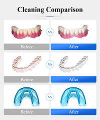 Tullker Household Ultrasonic Retainer Cleaner for Denture Jewelry Braces Cleaning with UV Light