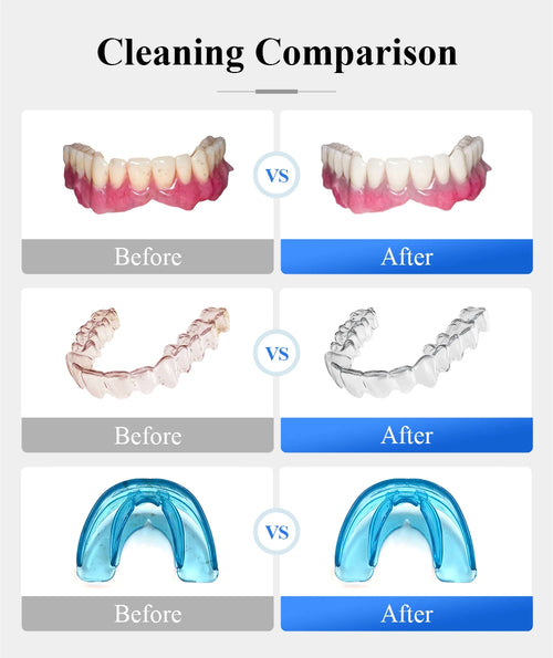 Tullker Household Ultrasonic Retainer Cleaner for Denture Jewelry Braces Cleaning with UV Light