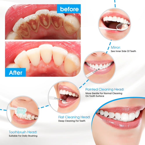 Ultrasonic Electric Sonic Dental Scaler Stain Tartar Calculus Remover Teeth Whitening Cleaning Waterproof Electric Toothbrush