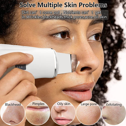 Blackhead Remover Ultrasonic Skin Scrubber Facial Pore Acne Peeling Spatula Blackhead Removal Shovel Face Deep Cleaning Device