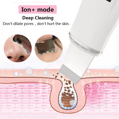 Blackhead Remover Ultrasonic Skin Scrubber Facial Pore Acne Peeling Spatula Blackhead Removal Shovel Face Deep Cleaning Device