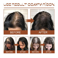 EELHOE Batana Oil Conditioner Moisturizes, Repairs, Strengthens Hair Roots, Prevents Supple, Dense Hair, And Solidifies And Fluffy Hair EasyOptionXY LLC