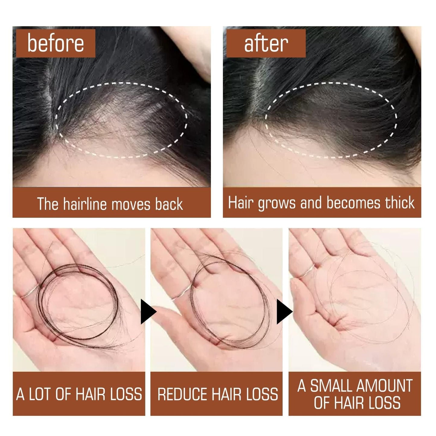 Batana Oil From Honduras - Get Fuller, Thicker, Healthier Hair - Great Gifts For Women Men Conditioner Haircare Silky - Hair Nutrition EasyOptionXY LLC