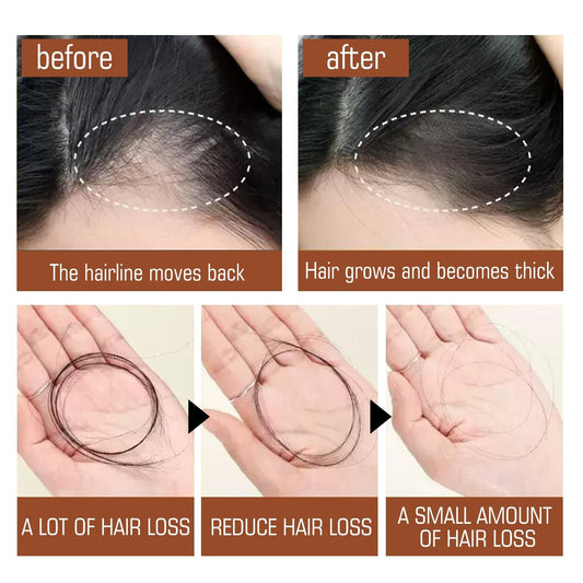Batana Oil From Honduras - Get Fuller, Thicker, Healthier Hair - Great Gifts For Women Men Conditioner Haircare Silky - Hair Nutrition EasyOptionXY LLC