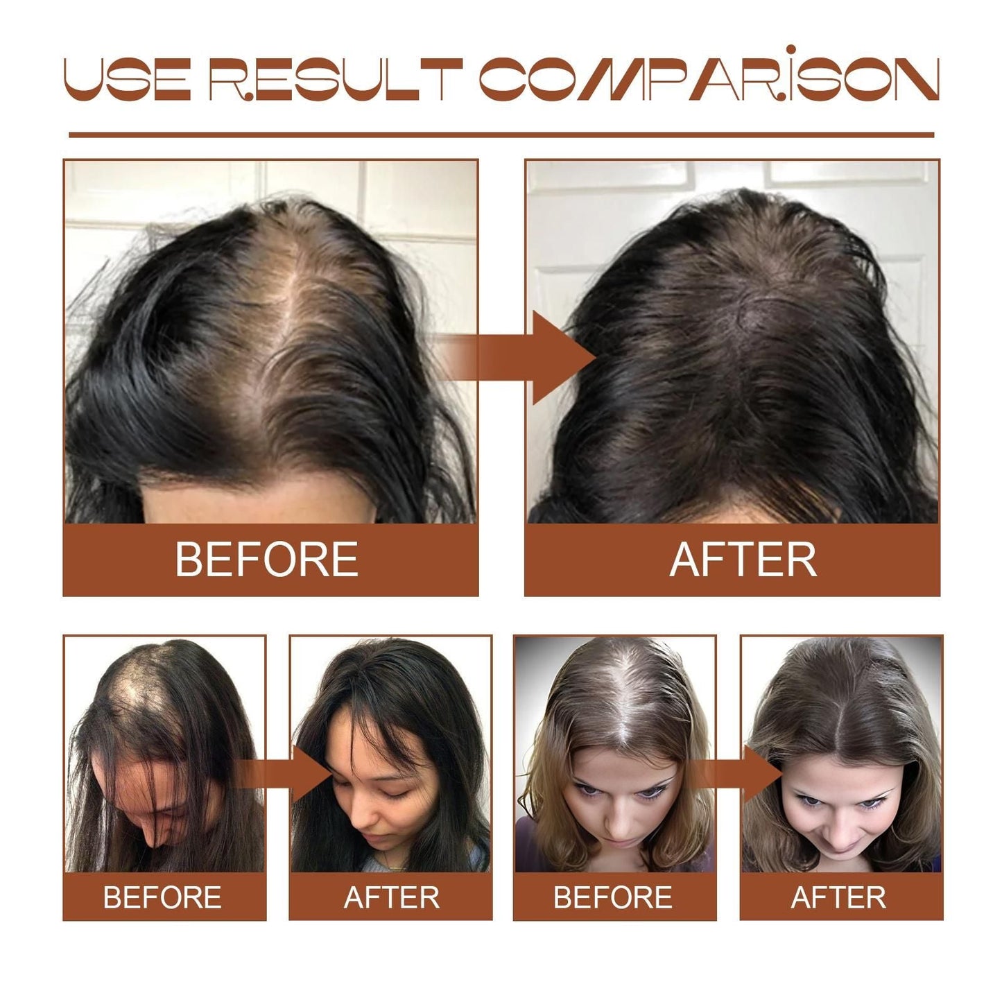 Batana Oil From Honduras - Get Fuller, Thicker, Healthier Hair - Great Gifts For Women Men Conditioner Haircare Silky - Hair Nutrition EasyOptionXY LLC