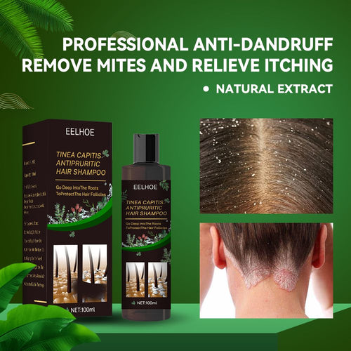 Anti-Dandruff Shampoo,Shampoo For Scalp Prone To Folliculitis, Dermatitis, Dandruff, Itchy And Flaky Scalp,Treats Dandruff And Seborrheic Dermatitis,Anti-Itch Shampoo EasyOptionXY LLC