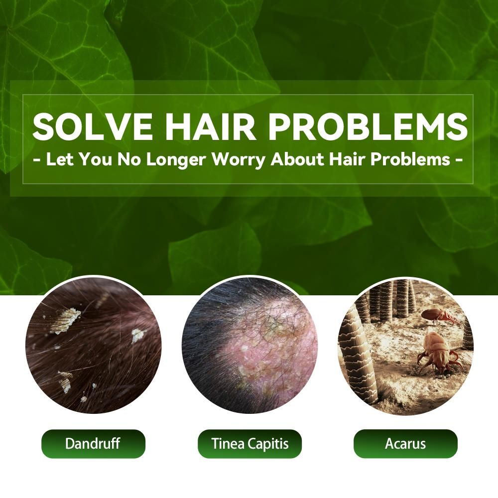 EELHOE Anti-Dandruff Shampoo - Itch Relief, Hair Loss Prevention, Oil Control & Refreshing Care EasyOptionXY LLC
