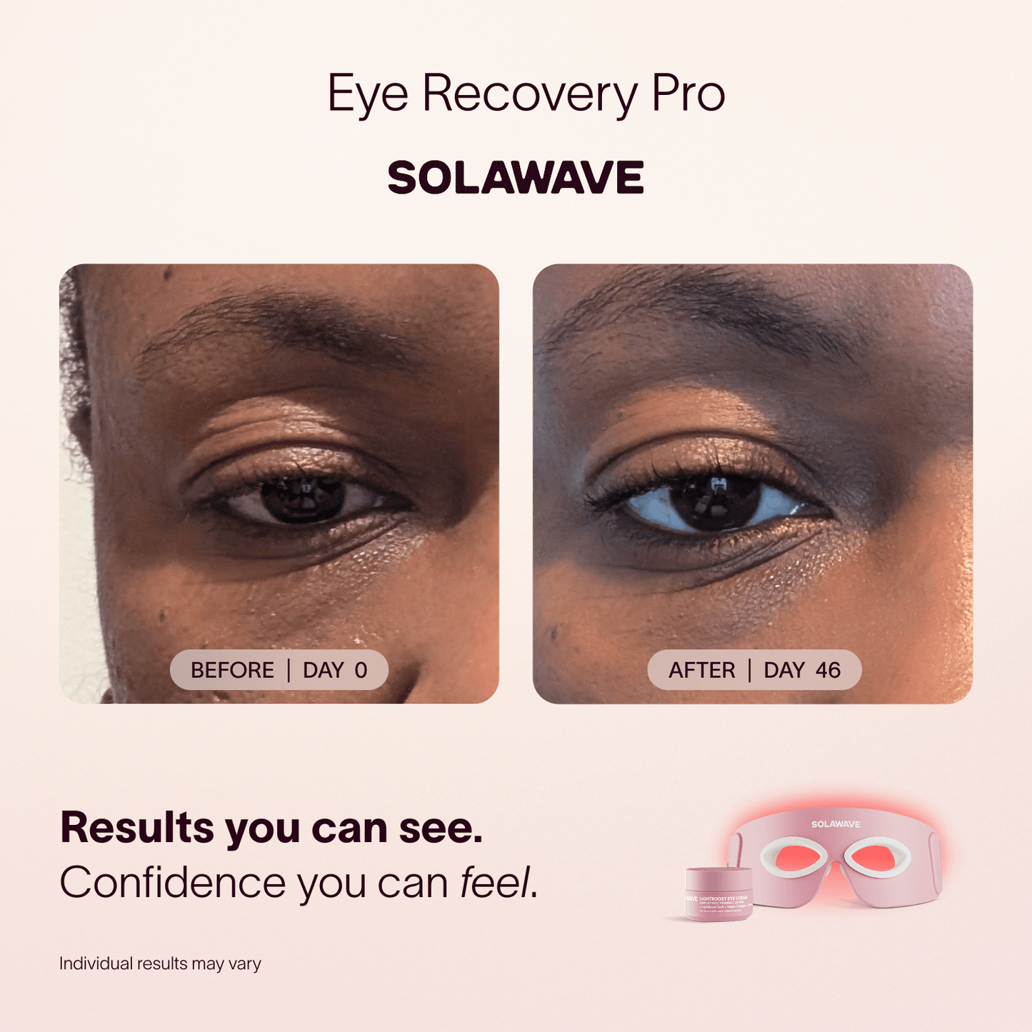 Solawave Solawave Eye Recovery Pro Kit
