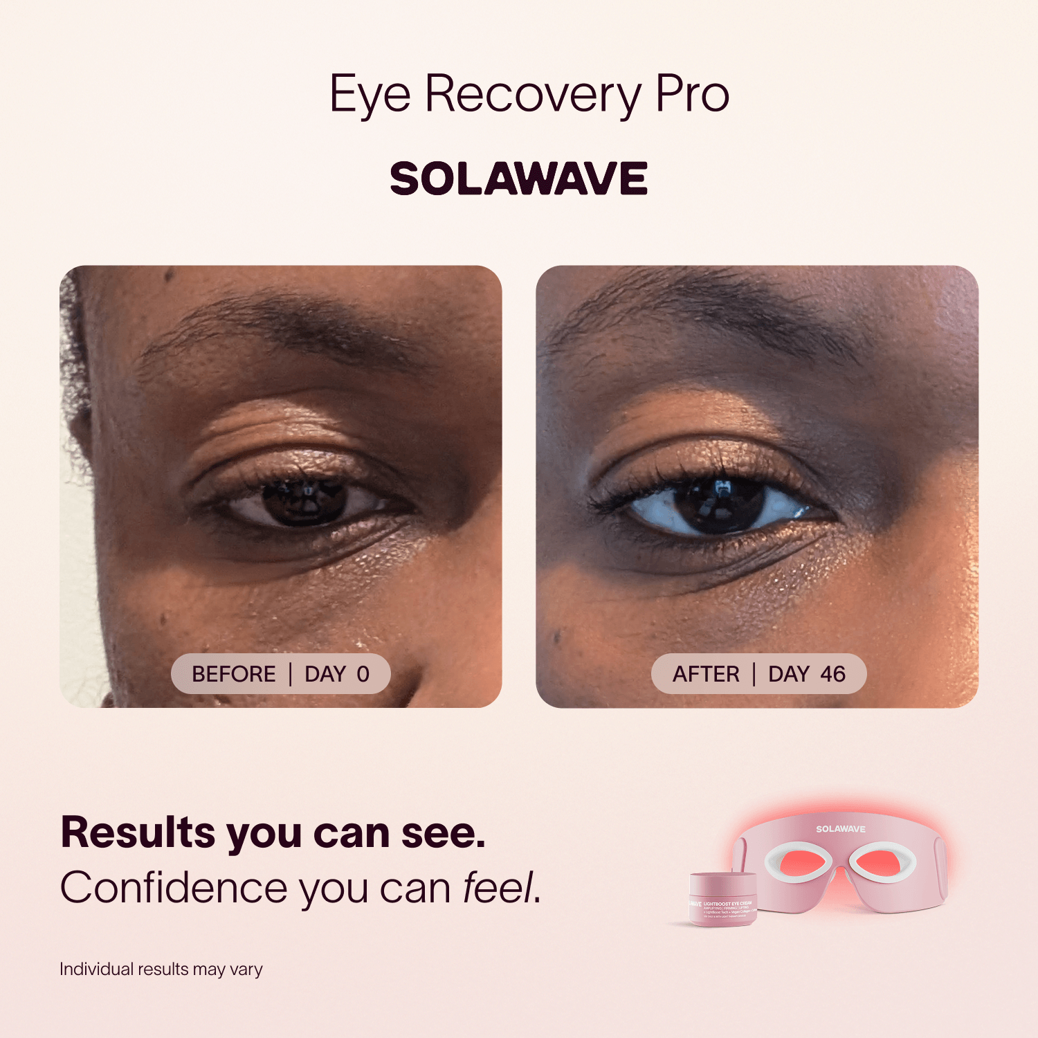 Solawave Solawave Eye Recovery Pro Kit
