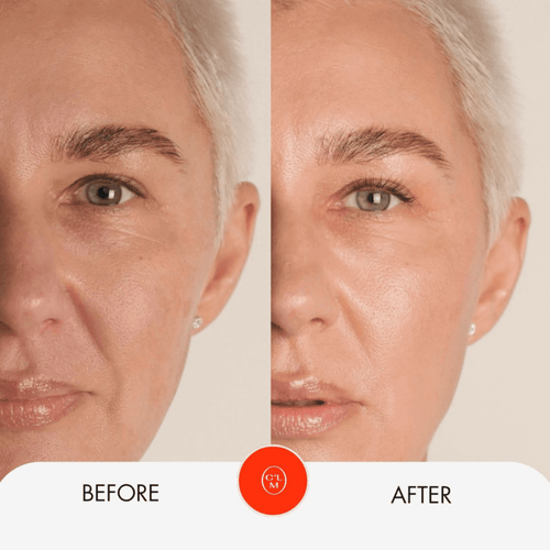 Moisturizing Facial Treatment Mask Celemi Cosmetics LLC