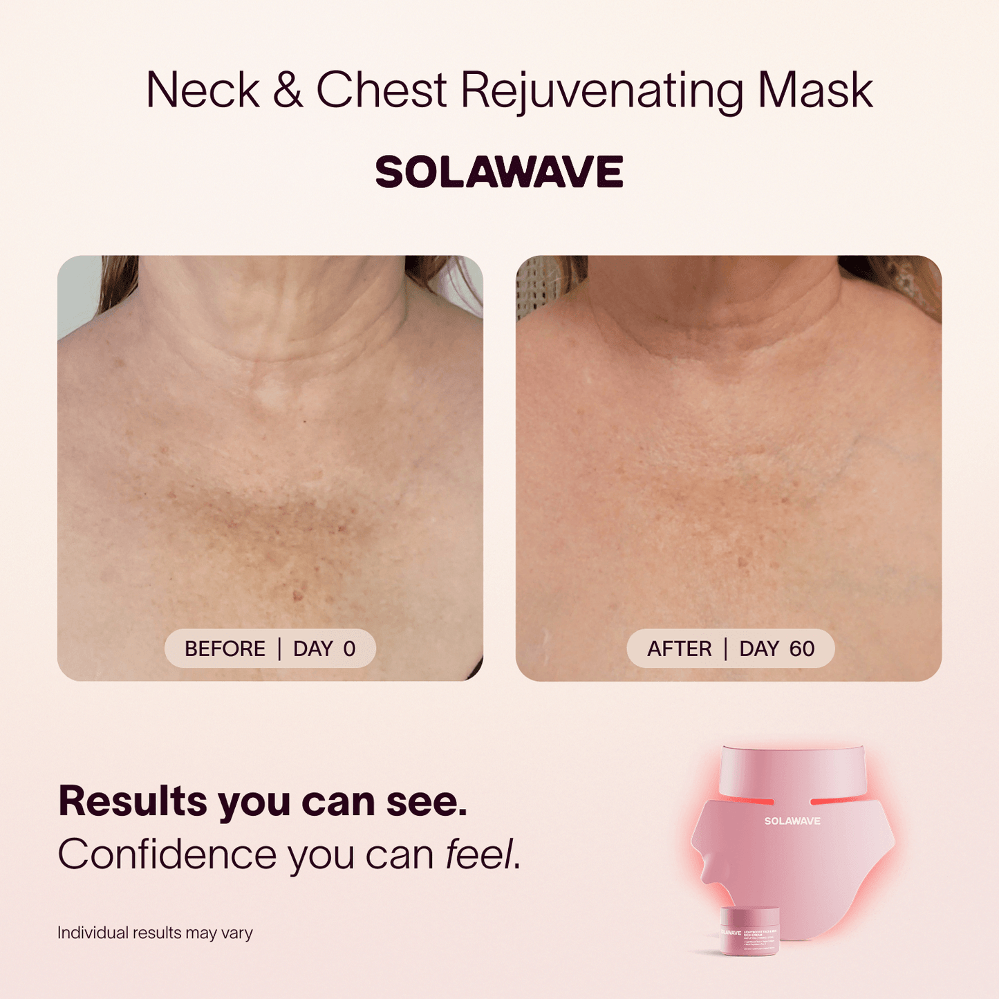 Solawave Solawave Neck & Chest LED Mask w/ LightBoost Cream Kit