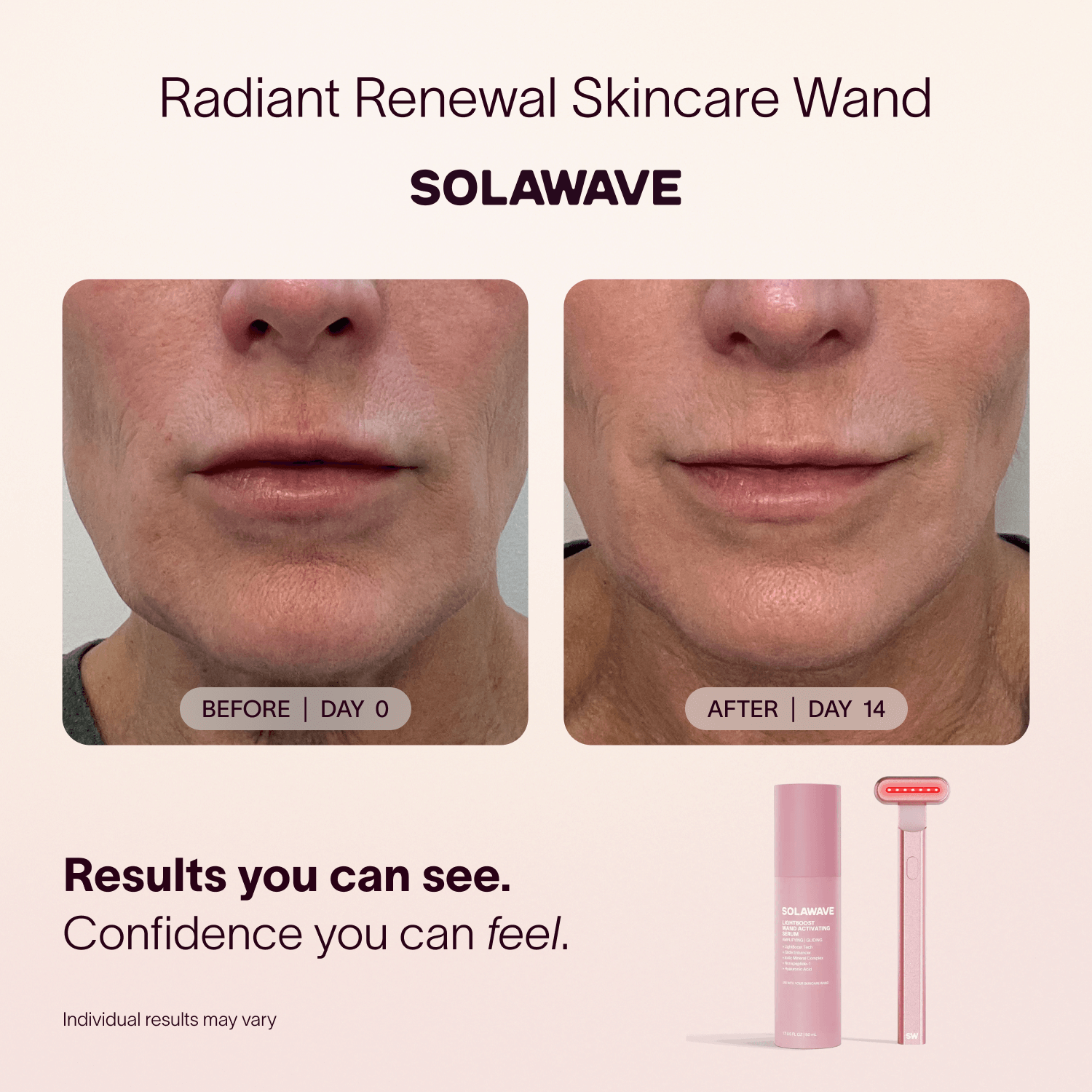 Solawave 4-in-1 Red Light Therapy Wand & Activating Serum Kit