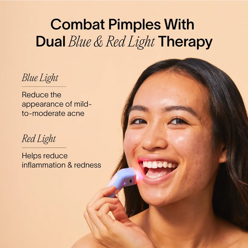 Bye Acne: 3-Minute Pimple Spot Treatment Solawave